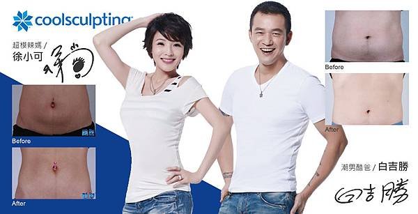 Coolsculpting-White-4-01