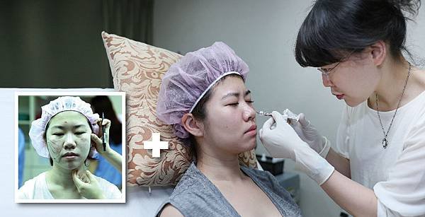 V-LOC+Hyaluronic-Ying-3