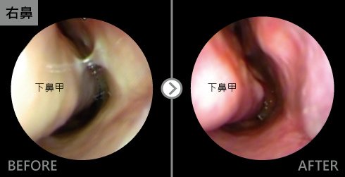 nose-l-5