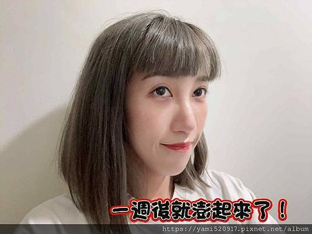 台北音波拉提診所分享 愛爾麗診所 𝐇𝐢𝐏𝐑𝐎-𝐒 龍捲風音波