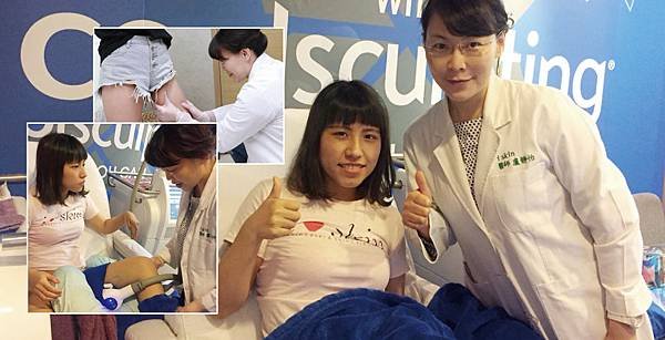 CoolSculpting-Madison-3
