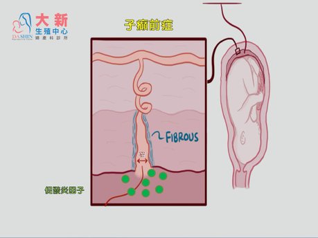 投影片5.JPG