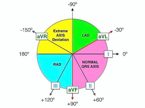 Haxaxial-ECG-Reference-FULL.jpeg