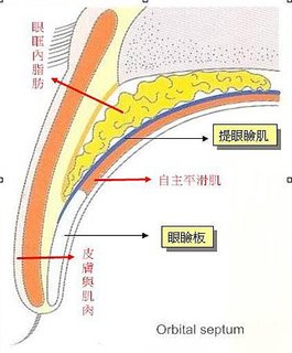 眼瞼1.jpg