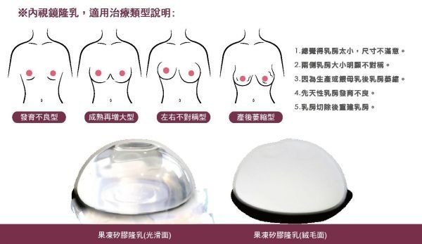 晶華美醫診所 台北隆乳手術推薦 隆乳女醫師 魔滴隆乳 內視鏡果凍矽膠隆乳 台北魔滴隆乳推薦 自體脂肪隆乳