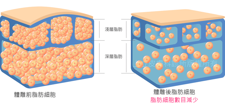 體雕的脂肪_浮水印