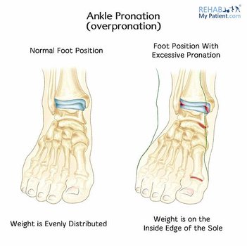 ankle_pronation.jpg