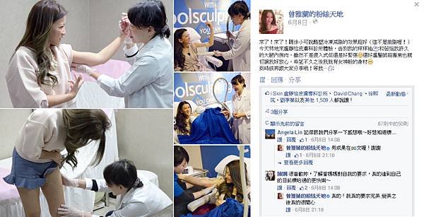 Zheng-Coolsculpting-3