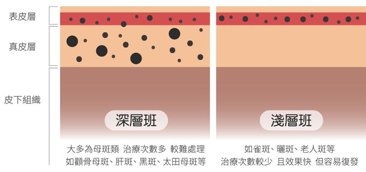 755蜂巢皮秒雷射皮秒雷射凹洞皮秒雷射恢復期皮秒雷射要打幾次皮秒雷射功效皮秒雷射毛孔皮秒雷射結痂皮秒755雷射多久打一次蜂巢皮秒雷射多久做一次07.jpg