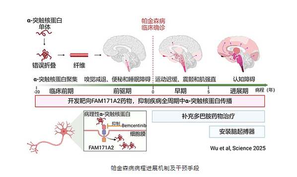 醫學突破 - 復旦大學在科學雜誌發表帕金森氏症治療全新靶點