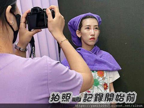 台北音波拉提診所分享 愛爾麗診所 𝐇𝐢𝐏𝐑𝐎-𝐒 龍捲風音波