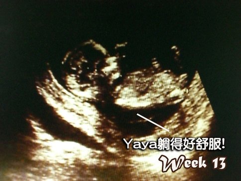 6. Pregnant week 13.jpg