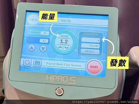 台北音波拉提診所分享 愛爾麗診所 𝐇𝐢𝐏𝐑𝐎-𝐒 龍捲風音波