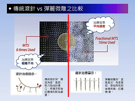 傳飛與彈飛比較