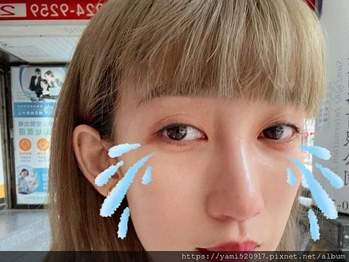 台北音波拉提診所分享 愛爾麗診所 𝐇𝐢𝐏𝐑𝐎-𝐒 龍捲風音波