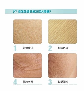 20190805_Allergan_Volite_三折頁_頁面_5.jpg