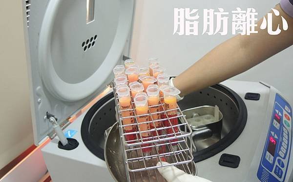 台中隆乳手術、台中自體脂肪隆乳、台中隆乳費用價格、台中水滴型(形)果凍隆乳、台中內視鏡隆乳、台中果凍矽膠豐胸隆乳、台中蜜桃絨隆乳、台中乳暈隆乳、台中豐胸、台中腋下隆乳、台中肚臍隆乳、台中筋膜下隆乳、台中自體移植脂肪隆乳、台中隆乳按摩、台中隆乳術後按摩、台中隆乳價格、台中隆乳價錢、台中隆乳推薦醫師、台中隆乳權威名醫、台中整形外科醫學美容、台中菲仕美診所、台灣隆乳隆胸手術專家，林孟羲院長｜楊學穎醫師｜許永昌醫師｜朱純慧醫師