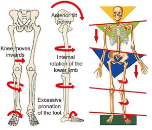 pronation-skeleton.png