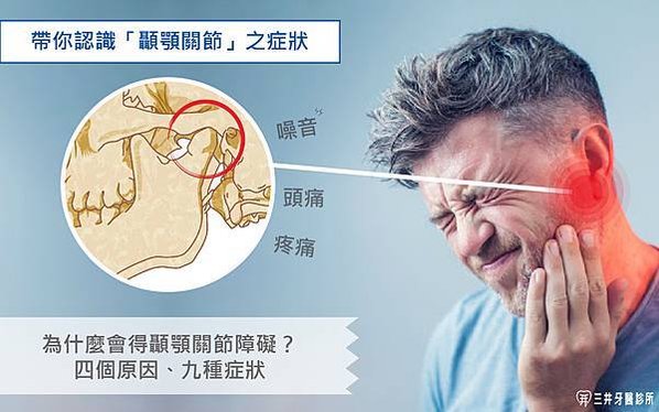 顳顎關節-01