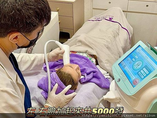 台北音波拉提診所分享 愛爾麗診所 𝐇𝐢𝐏𝐑𝐎-𝐒 龍捲風音波