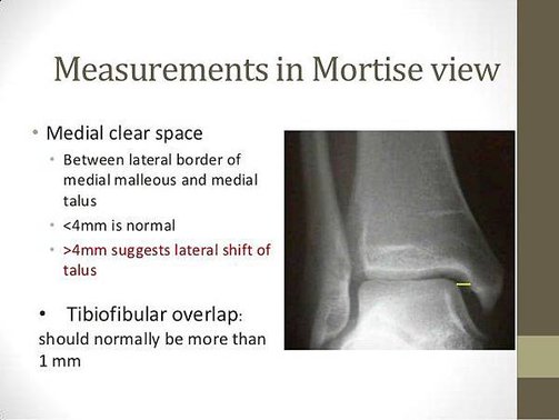 ankle-joint-radiography-20-638.jpg