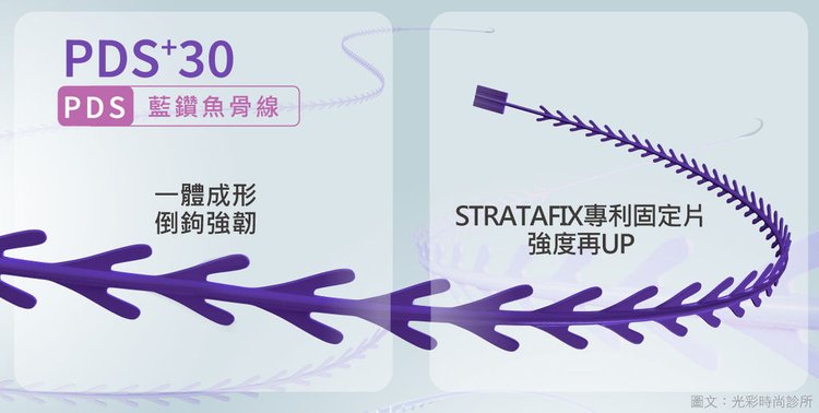 光彩魚骨線螺旋式拉提埋線拉提失敗埋線拉提費用埋線拉提副作用埋線拉提ptt埋線拉提推薦埋線拉提後遺症埋線拉提術後埋線拉提恢復期臉部埋線拉提費用中醫埋線拉提雙下巴醫美雙下巴拉提雙下巴運動下顎線拉提下顎線輪廓線臉部埋線費用.jpg