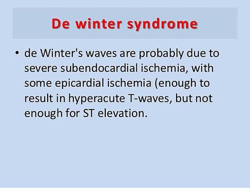 stemi-equivalents-12-638.jpg