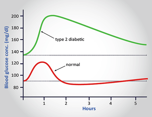 glucosetolerancetest