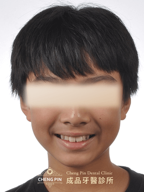 BA1.png