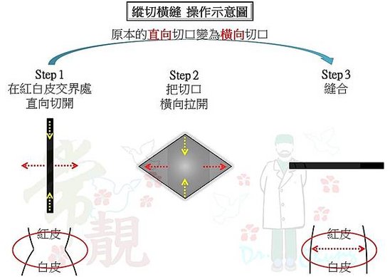 縱切橫縫示意圖.jpg