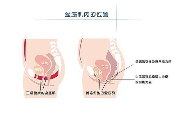 BTL幸福椅 G動-05