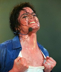 michael-jacksons-vitiligo.jpg