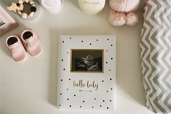 polka-dot-baby-memory-book-with-sonogram