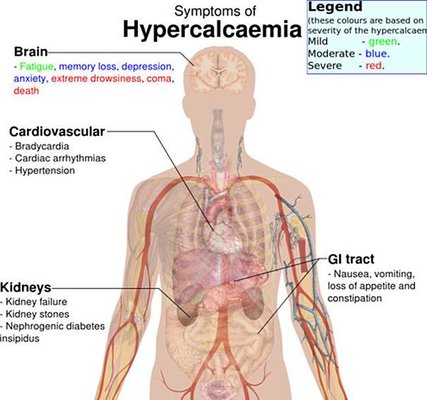 1-hypercalcaemia-05.jpg