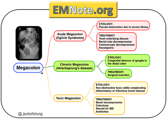 megacolon01_orig.png