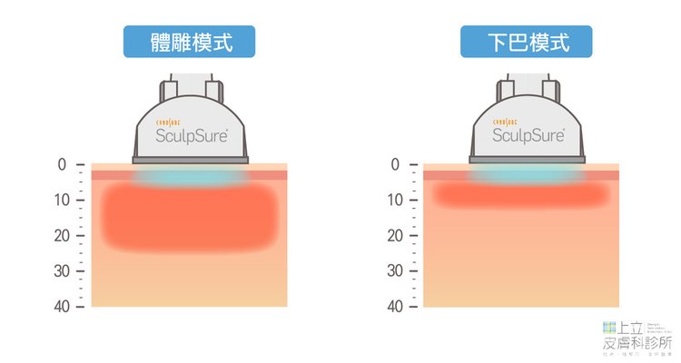 3體雕模式 下巴模式.jpg