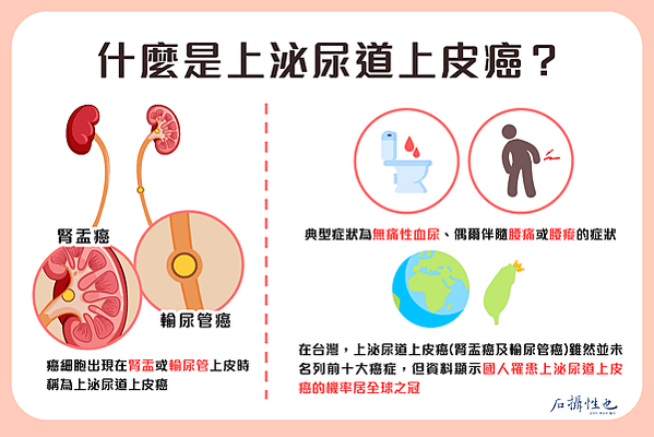 上泌尿道上皮癌系列1_工作區域 1