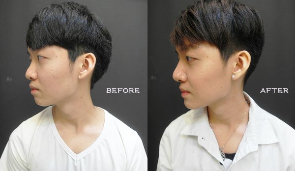 beforeafter