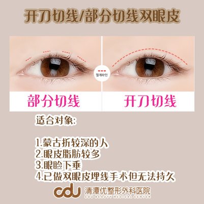 開刀雙眼皮.jpg