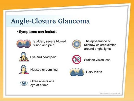 adjusting-to-life-with-glaucoma-13-638.jpg