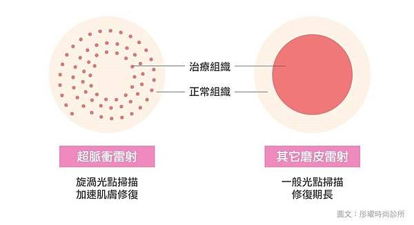 acupulse超脈衝雷射痘疤雷射痘疤治療除凹疤彤曜診所沈育如醫師皮膚專科高雄醫美推薦07.jpg