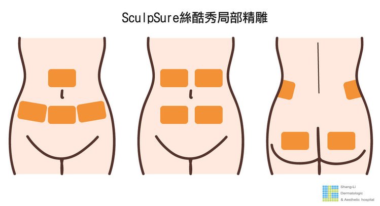 SculpSure體雕減肥減肥藥不好絲酷秀術後修復價格恢復期雷射體雕二極體冷凍溶脂減肥日記費用減肥食譜術後雷射溶脂局部平坦小腹塑身曲線雕塑林上立上立皮膚科診所.jpg