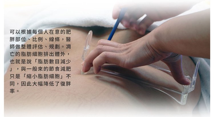 MICOOL-S冷凍溶脂效果冷凍溶脂價錢冷凍減脂心得冷凍溶脂推薦冷凍溶脂ptt冷凍溶脂原理冷凍溶脂術後瘦肚子的方法快速瘦肚子運動瘦肚子按摩快速瘦小腹運動瘦肚子飲食瘦肚子08.jpg