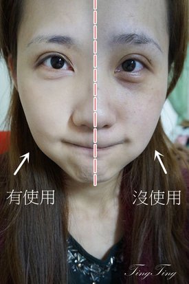 tingting_20150821