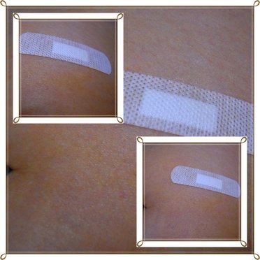 2011.02.15羊膜穿刺.jpg