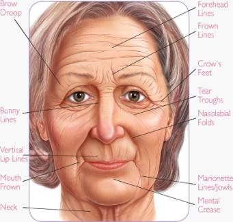 Wrinkles