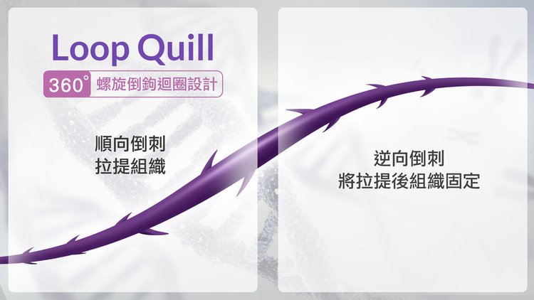 埋線拉提副作用埋線拉提費用埋線拉提推薦埋線拉提術後埋線拉提ptt埋線拉提後遺症埋線拉提效果玫瑰線拉提價格4d埋線拉皮推薦平滑線拉提法令紋治療推薦光彩時尚診所郭弘義醫師03.jpg
