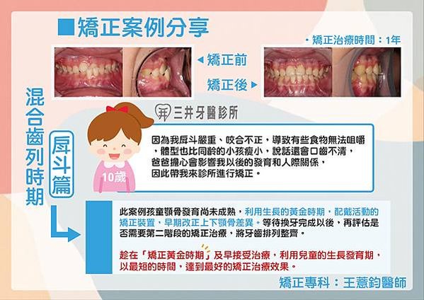 混合齒列-戽斗-01