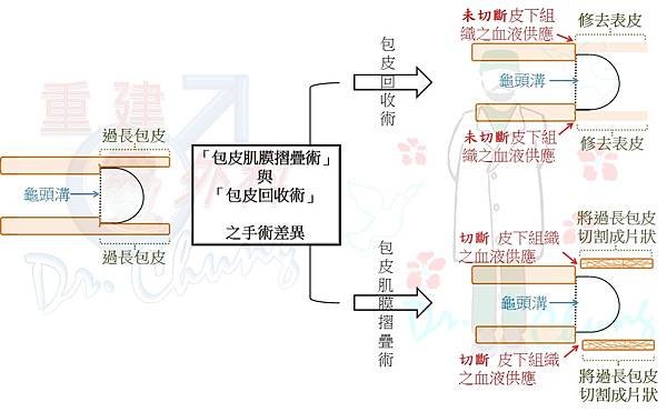 手術差異.jpg