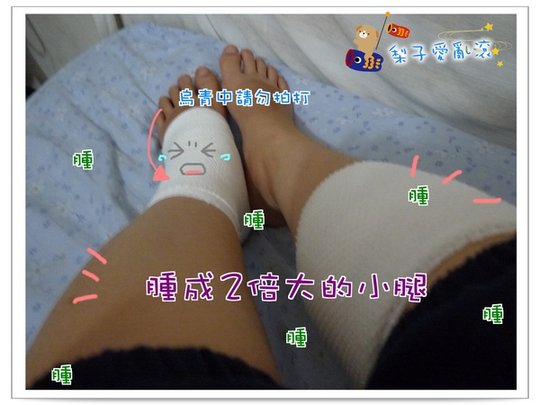 烏青.jpg